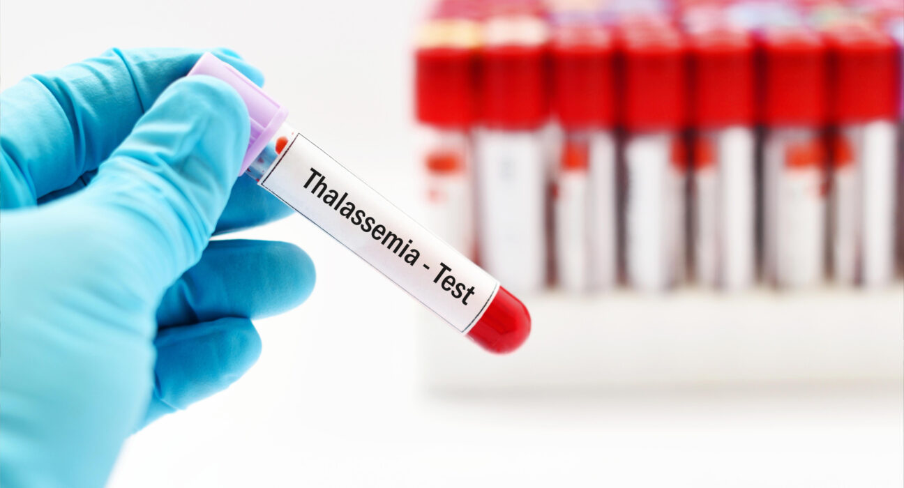 Thalassemia Parent Pulse Article Featured Image