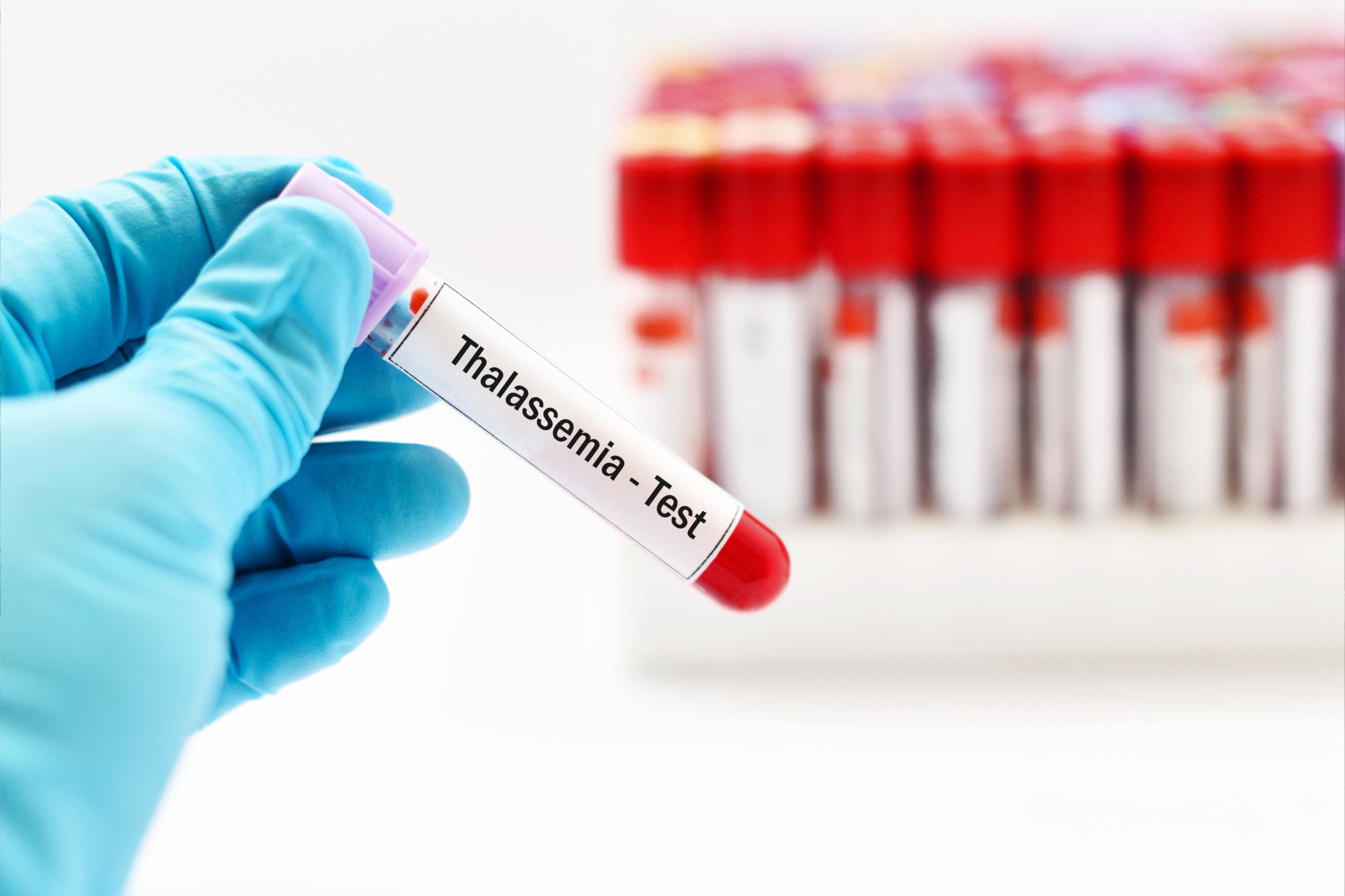 Thalassemia Parent Pulse Article Featured Image