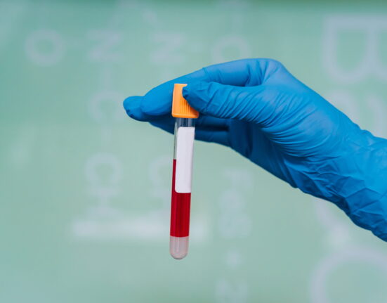 Parent Pulse Article Featured Image MP Test